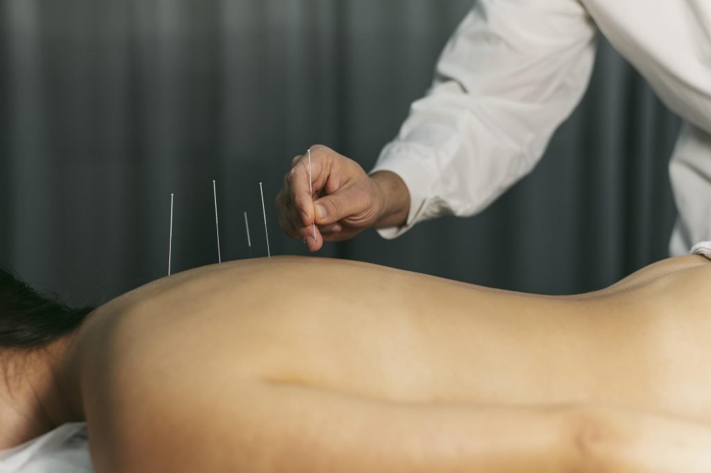 Acupuncturist in Goes